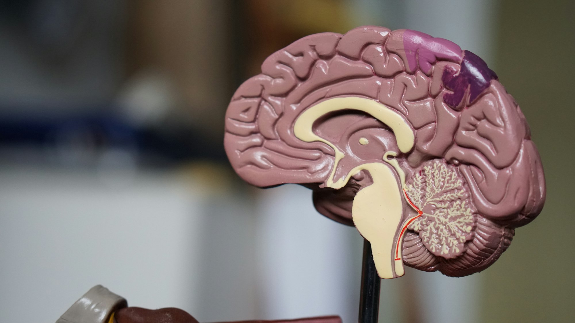 Anatomical model of a human brain showing the cerebrum and cerebellum, representing Noble Attorneys' traumatic brain injury practice